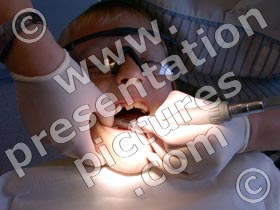 dentist at work - powerpoint graphics