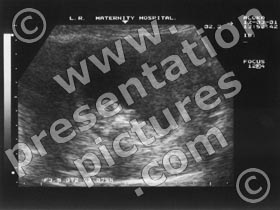 ultrasound - powerpoint graphics